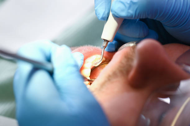 Best Emergency Dental Care for Sports Injuries in Patton Village, TX