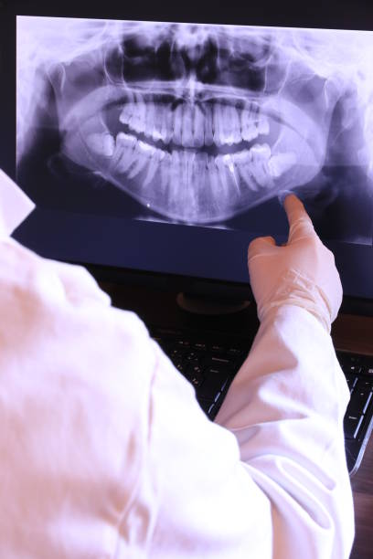 Best Emergency Treatment for Oral Infections in Patton Village, TX